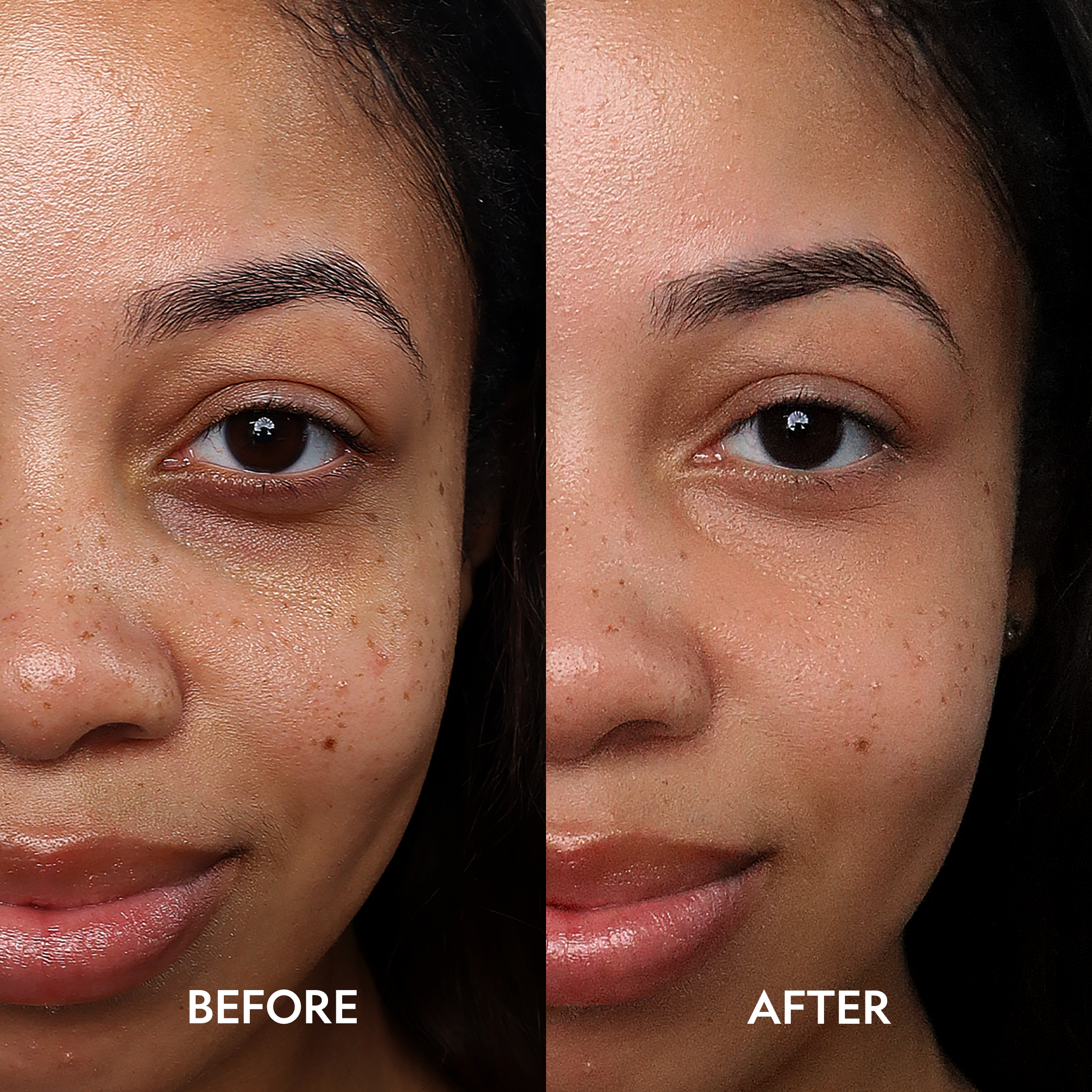 YENSA Super Bright Dark Circle Serum Peptide Corrector eye corrector with before and after images showing brightened under-eye area.