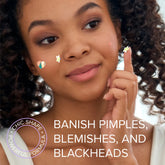 Maree pimple and acne patches applied to clear skin showing small transparent spots on blemishes.