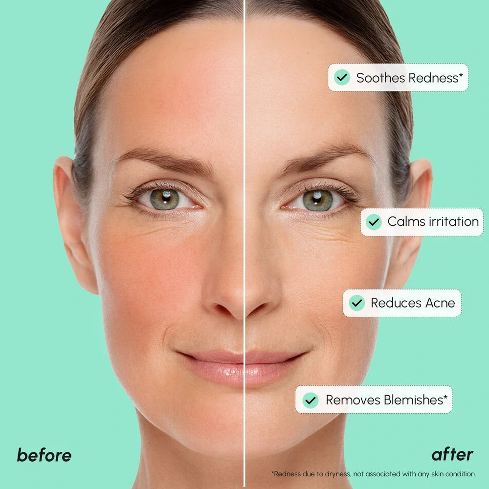 Maree Redness Soothing Azelaic Acid Serum in a clear bottle with dropper, designed to reduce redness and calm skin.