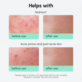 Maree Redness Soothing Azelaic Acid Serum in a clear dropper bottle, designed to reduce redness and calm sensitive skin.