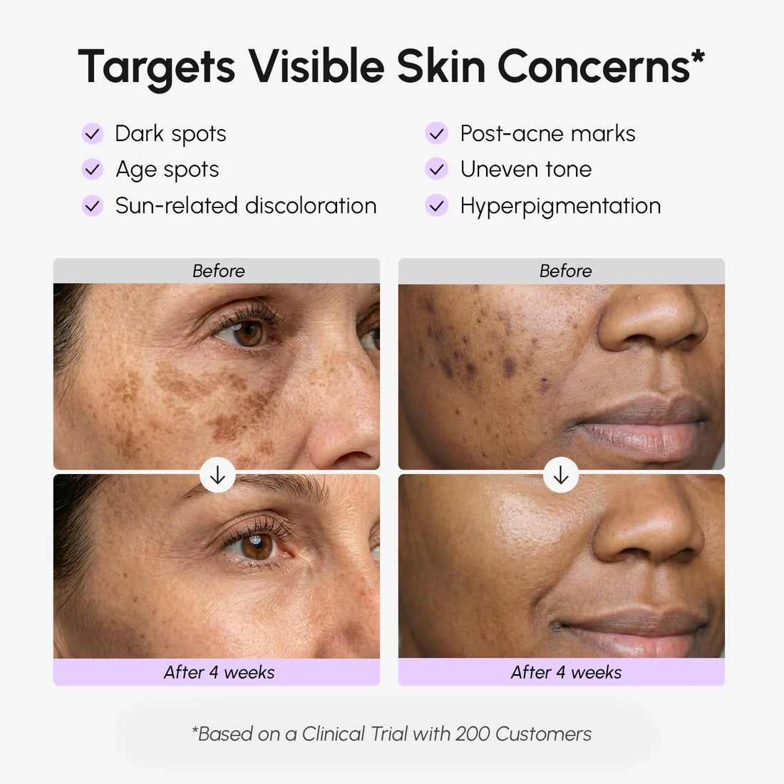 Maree face and body serum for dark spots, showing a sleek bottle with a dropper and a smooth, radiant skin surface.
