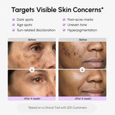 Maree face and body serum for dark spots, showing a sleek bottle with a dropper and a smooth, radiant skin surface.