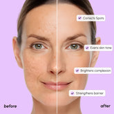 Maree Dark Spot Corrector serum applied to face, showing smooth skin with even tone and targeted treatment for dark spots.