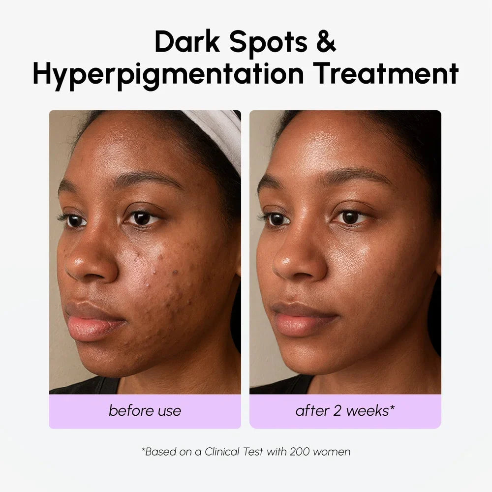 Maree dark spot corrector face serum with TXA, showing a sleek bottle and applicator for reducing dark spots and uneven skin tone.