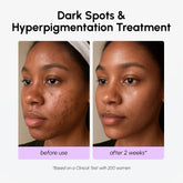 Maree dark spot corrector face serum with TXA, showing a sleek bottle and applicator for reducing dark spots and uneven skin tone.