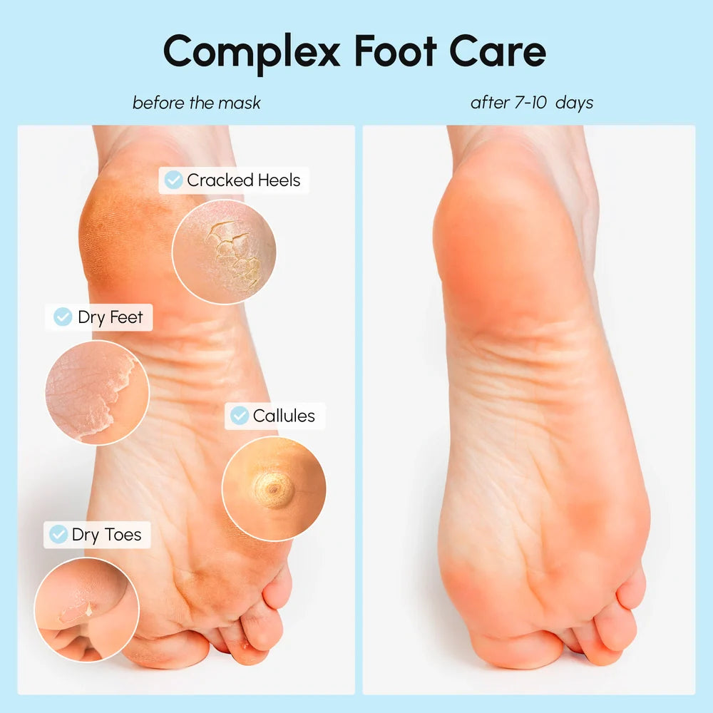 Maree exfoliating and hydrating foot mask showing a pair of feet with the mask applied for soft, smooth skin.