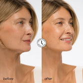 Maree Hyaluronic Acid V-line Lifting Mask showing a close-up of the mask with hyaluronic acid ingredients on a white background.