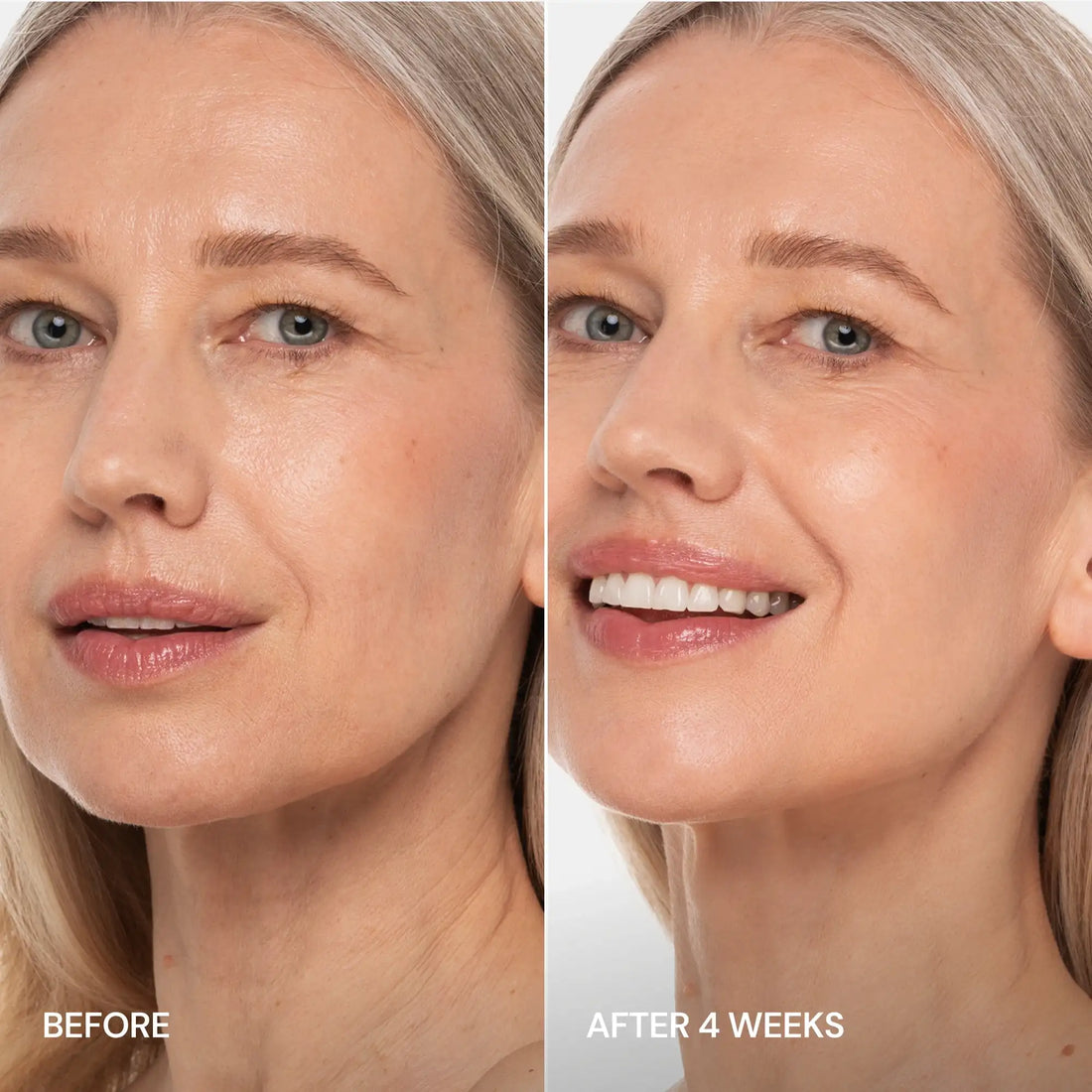 Maree Pro-Retinol Neck Lifting Cream Massager applying cream to a woman&