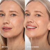 Maree Pro-Retinol Neck Lifting Cream Massager applying cream to a woman&