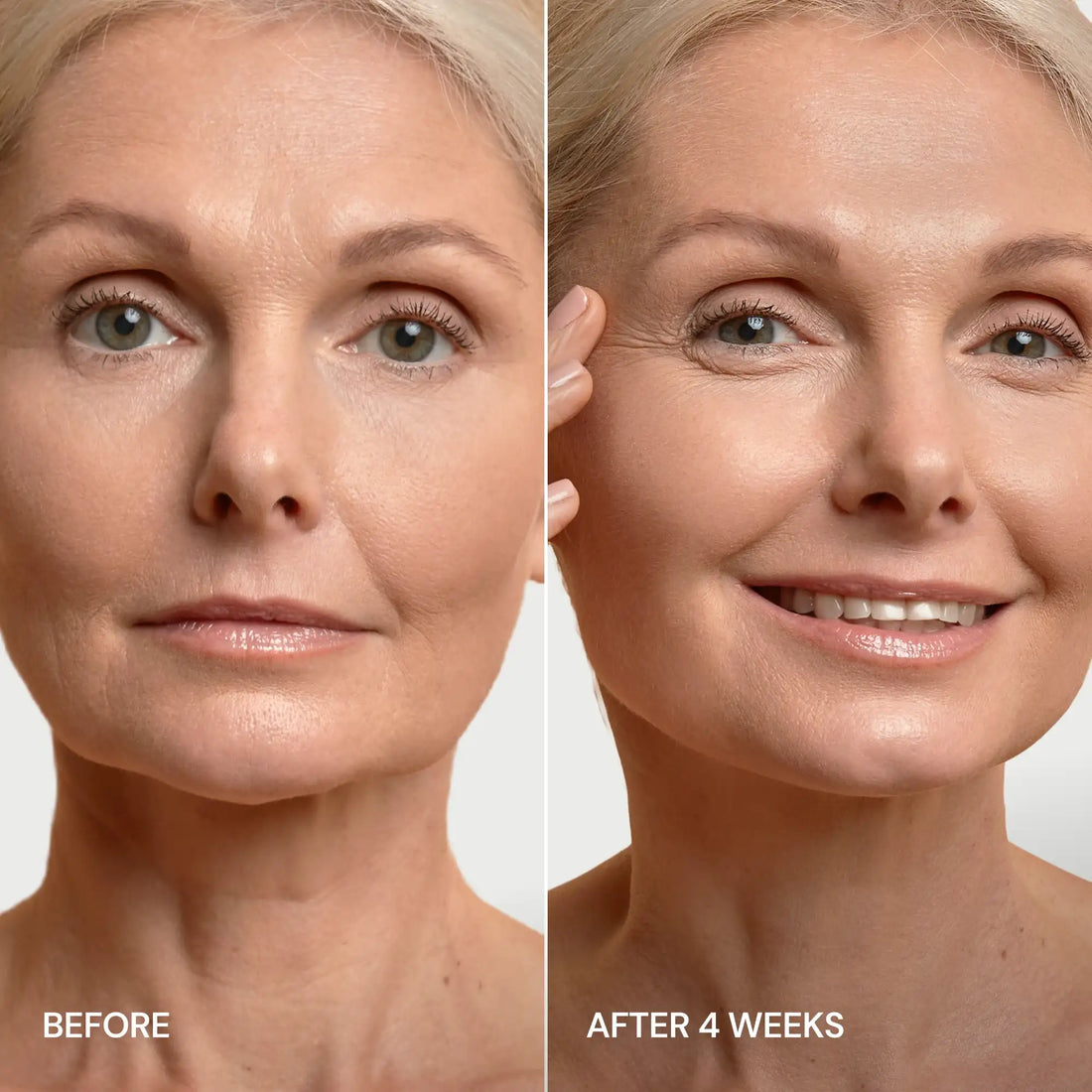 Maree Pro-Retinol Neck Lifting Cream Massager applying to neck area, showing device and skincare product for skin firming.