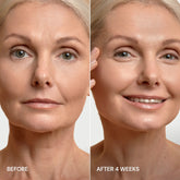 Maree Pro-Retinol Neck Lifting Cream Massager applying to neck area, showing device and skincare product for skin firming.