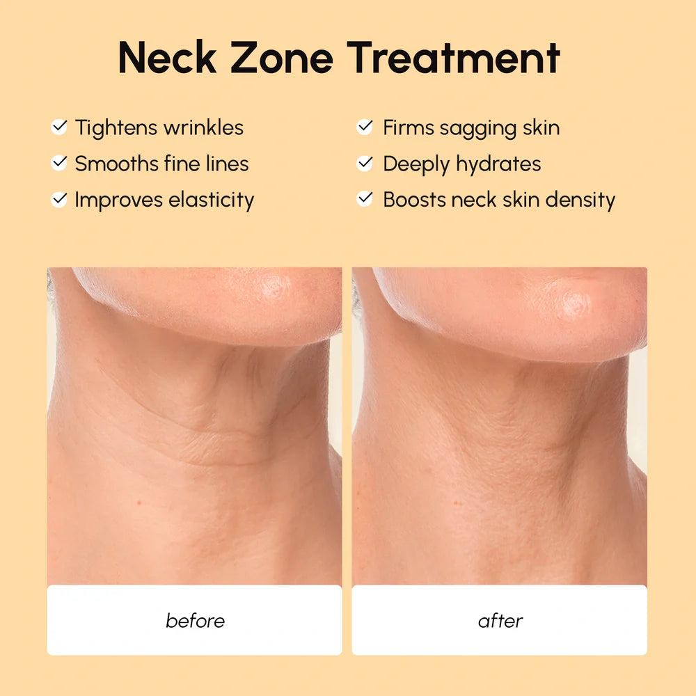 Maree lifting neck wrinkle patches on a woman&