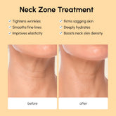 Maree lifting neck wrinkle patches on a woman&