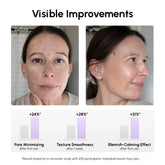 Maree 12% Niacinamide Smooth & Glow Pads, skincare product with textured pads for brightening and refining skin.