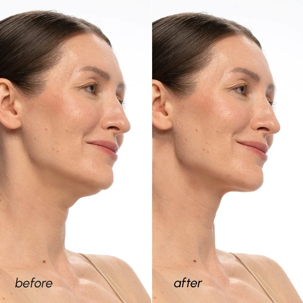Maree PDRN V-line Lifting Mask featuring a soft, hydrating fabric sheet designed to sculpt and lift facial contours.