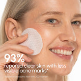 Maree Witch Hazel Clearing Pads showing a close-up of soft cotton pads soaked with witch hazel solution for facial cleansing