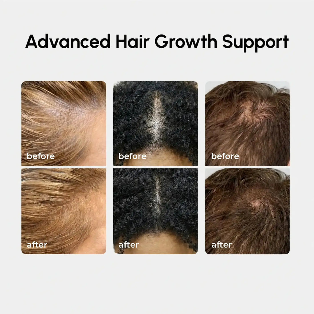 Maree 4-in-1 Hair Growth Spray bottle with nozzle, designed to promote hair growth and scalp health.