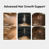 Maree 4-in-1 Hair Growth Spray bottle with nozzle, designed to promote hair growth and scalp health.