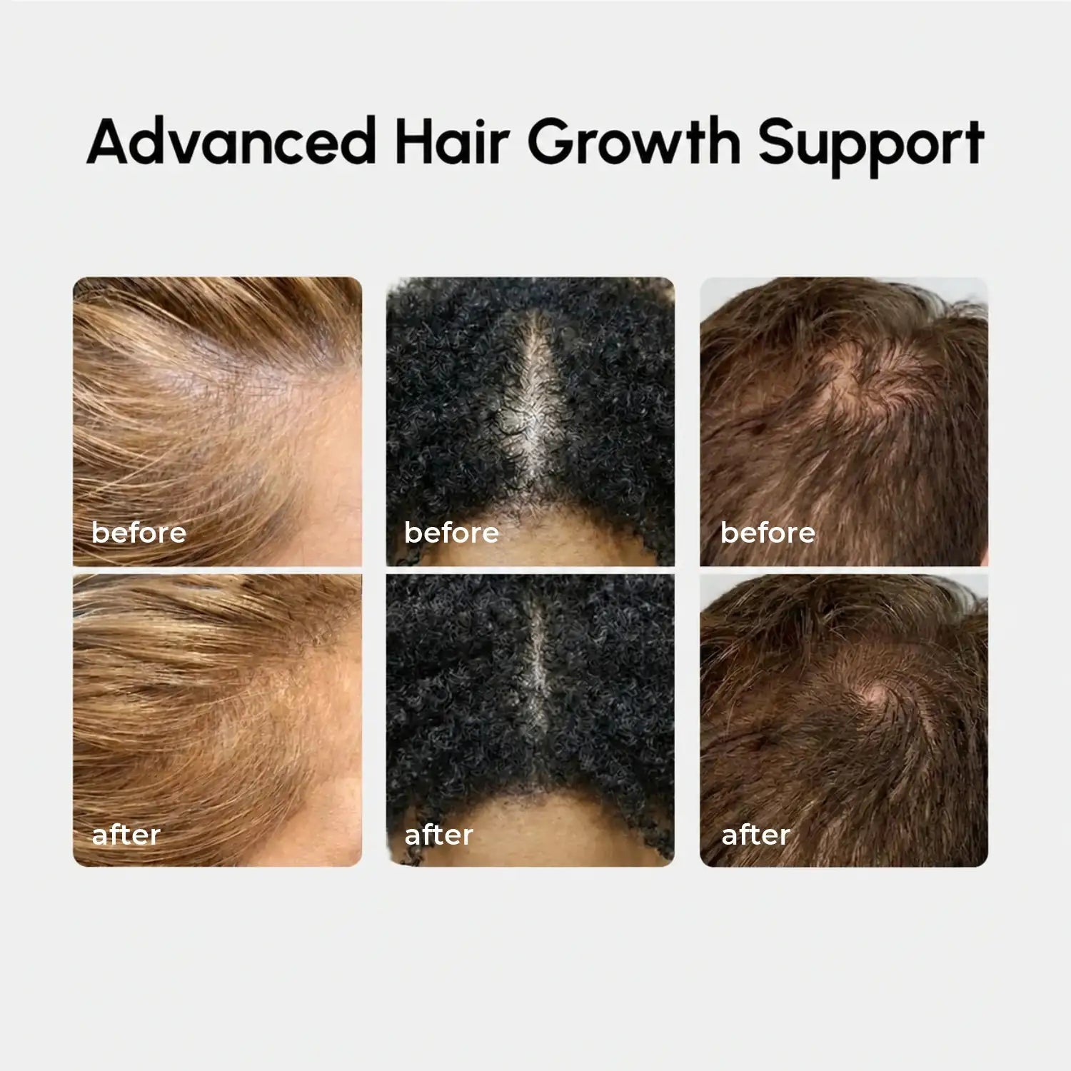 Maree 4-in-1 Hair Growth Spray bottle with nozzle, designed to promote hair growth and scalp health.