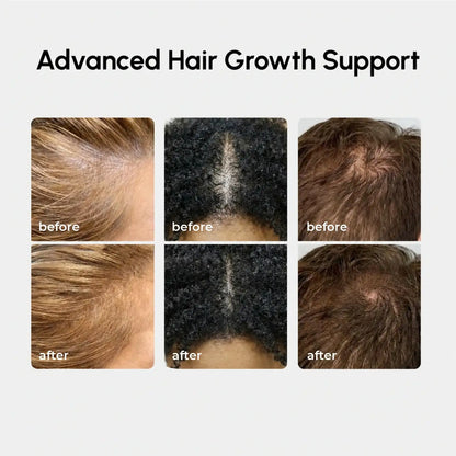 Maree 4-in-1 Hair Growth Spray bottle with nozzle, designed to promote hair growth and scalp health.