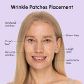 Maree anti-wrinkle tape patches applied to skin showing their discreet, skin-toned design for reducing facial wrinkles.