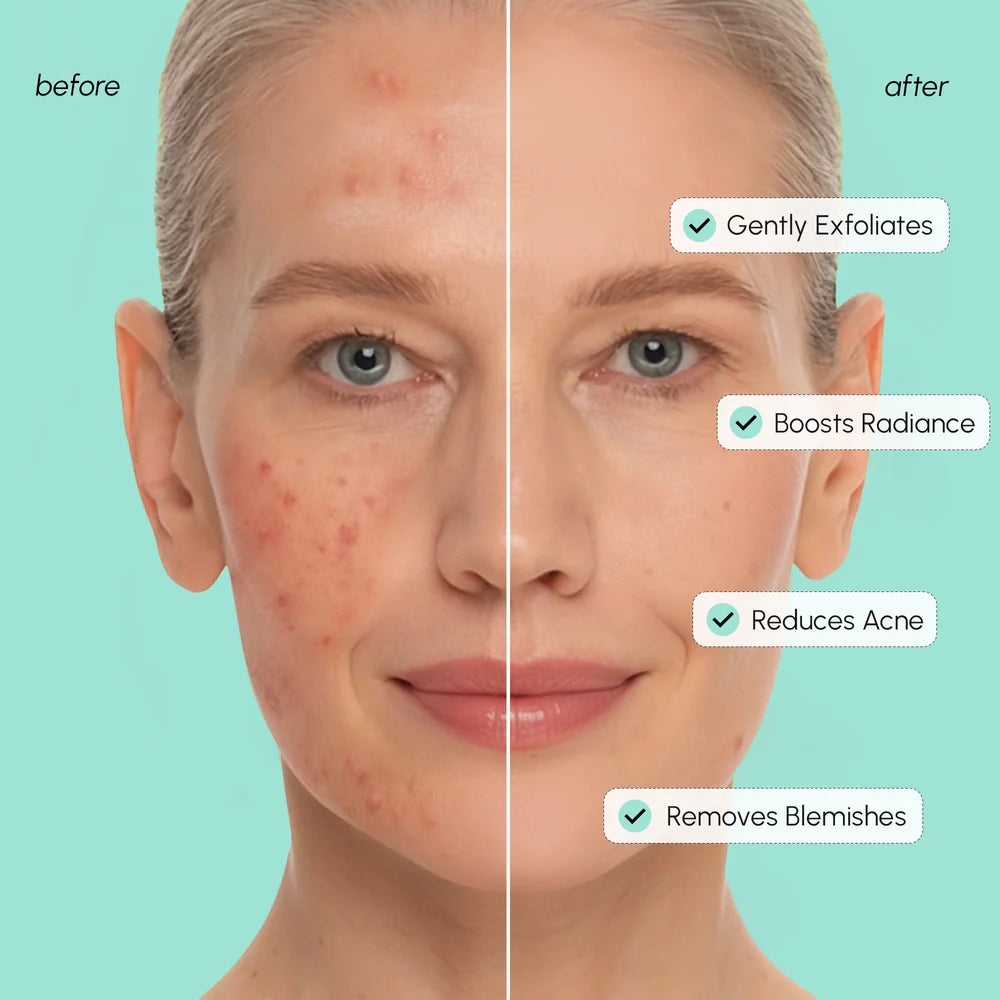 Maree Azelaic Acid Soothing Pads with soft cotton pads soaked in azelaic acid for gentle skincare and skin calming.
