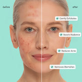Maree Azelaic Acid Soothing Pads with soft cotton pads soaked in azelaic acid for gentle skincare and skin calming.
