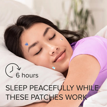 Set of six Maree pimple and acne patches on clear skin, showing how they cover and treat blemishes effectively.