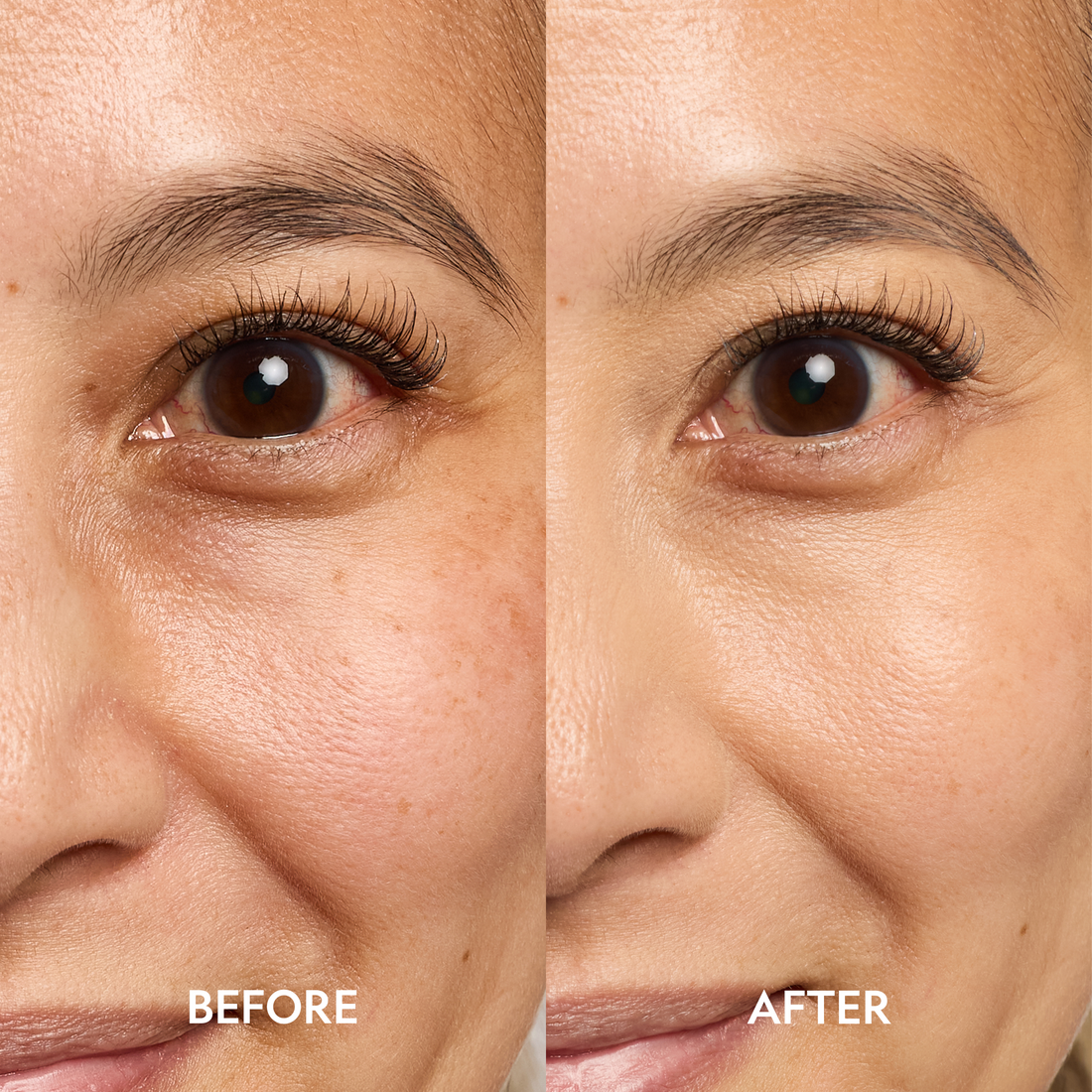 YENSA Super Bright Dark Circle Serum Peptide Corrector eye corrector with before and after images showing improved brightness and reduced dark circles