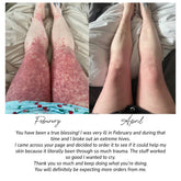 Before and after images showing Pretty Farm Girl fragrance-free tallow and honey cream applied to sensitive skin.