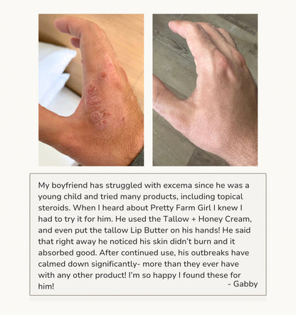 Pretty Farm Girl fragrance free tallow and honey cream for sensitive skin, showing a before and after skincare testimonial.