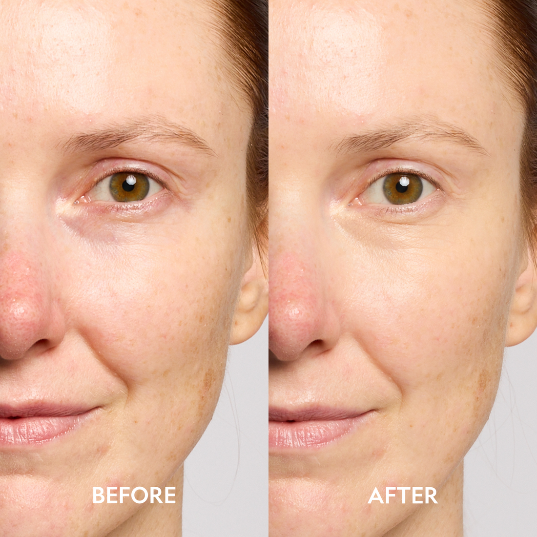 Before and after images showing YENSA Super Bright Dark Circle Serum Peptide Corrector for eye area with visible brightening effects